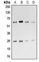 CD69 Antibody - Western blot analysis of CD69 expression in HeLa (A); Jurkat (B); mouse brain (C); mouse heart (D) whole cell lysates.