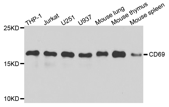 CD69 Antibody - Western blot analysis of extracts of various cell lines.