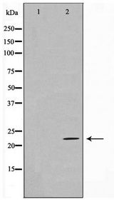 CD69 Antibody - Western blot of HUVEC cell lysate using CD69 Antibody