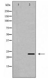 CD69 Antibody - Western blot of CD69 expression in Jurkat cell lysate