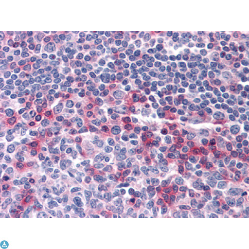 CD69 Antibody - Immunohistochemistry (IHC) analysis of paraffin-embedded Human Tonsil tissues with AEC staining using CD69 Monoclonal Antibody.