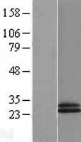 CD69 Protein - Western validation with an anti-DDK antibody * L: Control HEK293 lysate R: Over-expression lysate