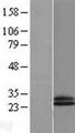 CD69 Protein - Western validation with an anti-DDK antibody * L: Control HEK293 lysate R: Over-expression lysate