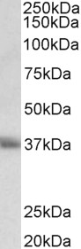 CD7 Antibody - CD7 antibody (0.5 ug/ml) staining of Human Thymus lysate (35 ug protein in RIPA buffer). Primary incubation was 1 hour. Detected by chemiluminescence.