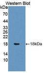 CD7 Antibody - Western blot of CD7 antibody with partial recombinant CD7.