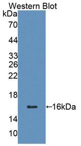 CD7 Antibody - Western blot of CD7 antibody.
