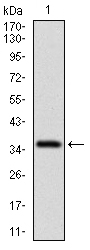 CD7 Antibody - Western blot using CD7 monoclonal antibody against human CD7 recombinant protein. (Expected MW is 36.6 kDa)