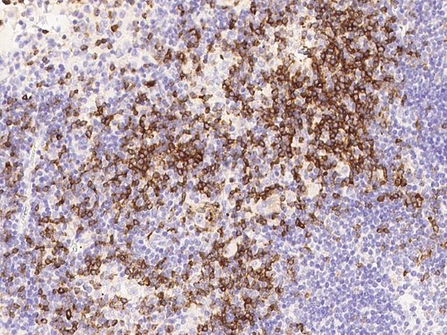 CD7 Antibody - Immunochemical staining of human CD7 in human lymph node with mouse monoclonal antibody at 1:60 dilution, formalin-fixed paraffin embedded sections.