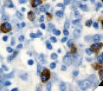 CD7 Antibody - IHC of CD7 on FFPE Tonsil tissue. This image was taken for the unmodified form of this product. Other forms have not been tested.