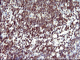 CD7 Antibody - IHC of paraffin-embedded Human lymph node tissue using anti-CD7 mouse monoclonal antibody. (Heat-induced epitope retrieval by 10mM citric buffer, pH6.0, 120°C for 3min).