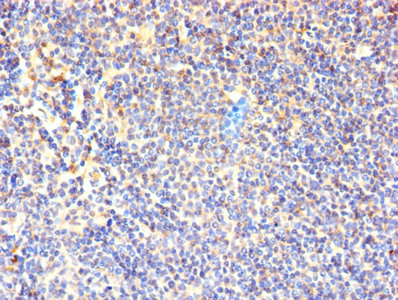 CD7 Antibody - Immunohistochemistry of paraffin-embedded human lymphoid tissue using CD7 Antibody at dilution of 1:100