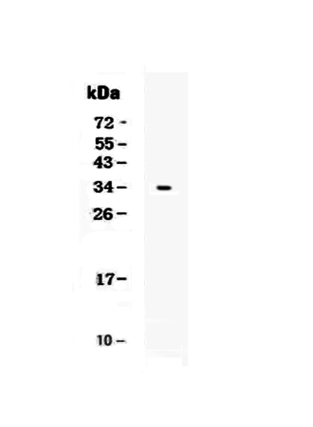 CD7 Antibody - Western blot analysis of CD7 using anti-CD7 antibody. Electrophoresis was performed on a 5-20% SDS-PAGE gel at 70V (Stacking gel) / 90V (Resolving gel) for 2-3 hours. Lane 1: recombinant human CD7 protein 1ng. After Electrophoresis, proteins were transferred to a Nitrocellulose membrane at 150mA for 50-90 minutes. Blocked the membrane with 5% Non-fat Milk/ TBS for 1.5 hour at RT. The membrane was incubated with rabbit anti-CD7 antigen affinity purified polyclonal antibody at 0.5 µg/mL overnight at 4°C, then washed with TBS-0.1% Tween 3 times with 5 minutes each and probed with a goat anti-rabbit IgG-HRP secondary antibody at a dilution of 1:10000 for 1.5 hour at RT. The signal is developed using an Enhanced Chemiluminescent detection (ECL) kit with Tanon 5200 system. A specific band was detected for CD7 at approximately 30-40KD. The expected band size for CD7 is at 18KD.