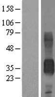 CD7 Protein - Western validation with an anti-DDK antibody * L: Control HEK293 lysate R: Over-expression lysate