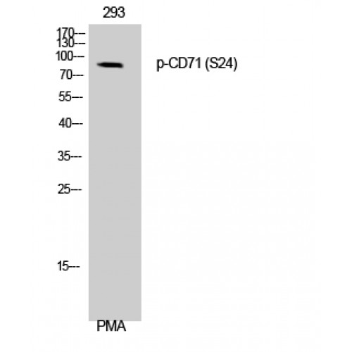 CD71 / Transferrin Receptor Antibody - Western blot of Phospho-CD71 (S24) antibody