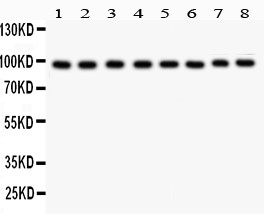 CD71 / Transferrin Receptor Antibody - TFRC antibody Western blot. All lanes: Anti TRFC at 0.5 ug/ml. Lane 1: HELA Whole Cell Lysate at 40 ug. Lane 2: JURAKT Whole Cell Lysate at 40 ug. Lane 3: RAJI Whole Cell Lysate at 40 ug. Lane 4: HL-60 Whole Cell Lysate at 40 ug. Lane 5: K562 Whole Cell Lysate at 40 ug. Lane 6: HEPG2 Whole Cell Lysate at 40 ug. Lane 7: Human Placenta Tissue Lysate at 50 ug. Lane 8: CEM Whole Cell Lysate at 40 ug. Predicted band size: 86 kD. Observed band size: 98 kD.