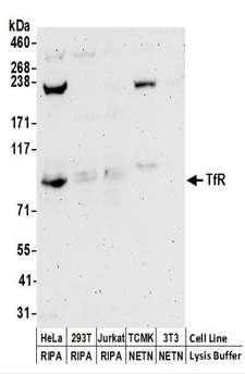 CD71 / Transferrin Receptor Antibody - Detection of Human TfR by Western Blot. Samples: Whole cell lysate (50 ug) prepared using NETN or RIPA buffer from HeLa, 293T, Jurkat, mouse TCMK-1, and mouse NIH3T3 cells. Antibodies: Affinity purified rabbit anti-TfR antibody used for WB at 0.1 ug/ml. Detection: Chemiluminescence with an exposure time of 3 minutes.