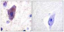 CD71 / Transferrin Receptor Antibody - Immunohistochemistry analysis of paraffin-embedded human brain tissue, using CD71/TfR Antibody. The picture on the right is blocked with the synthesized peptide.