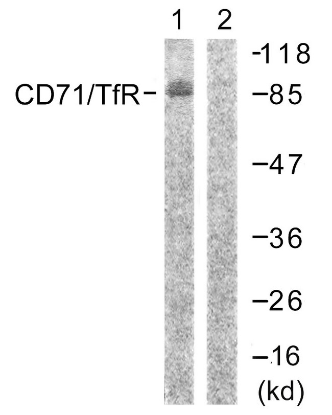 CD71 / Transferrin Receptor Antibody - Western blot analysis of lysates from 293 cells, treated with PMA 125ng/ml 30' , using CD71/TfR Antibody. The lane on the right is blocked with the synthesized peptide.