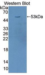 CD71 / Transferrin Receptor Antibody - Western blot of CD71 / Transferrin Receptor antibody.