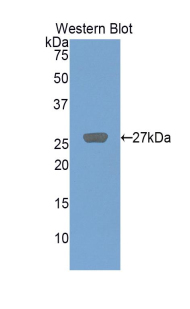CD71 / Transferrin Receptor Antibody - Western blot of recombinant CD71 / Transferrin Receptor.  This image was taken for the unconjugated form of this product. Other forms have not been tested.