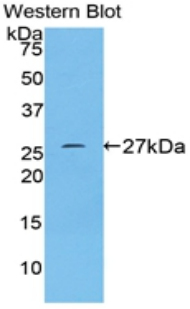 CD71 / Transferrin Receptor Antibody - Western blot of recombinant CD71 / Transferrin Receptor.  This image was taken for the unconjugated form of this product. Other forms have not been tested.