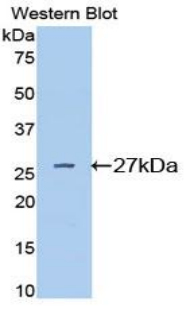 CD71 / Transferrin Receptor Antibody - Western blot of recombinant CD71 / Transferrin Receptor.  This image was taken for the unconjugated form of this product. Other forms have not been tested.