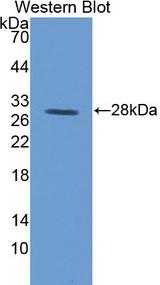 CD71 / Transferrin Receptor Antibody
