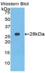CD71 / Transferrin Receptor Antibody - Western blot of CD71 / Transferrin Receptor antibody.