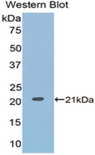 CD71 / Transferrin Receptor Antibody - Western blot of recombinant CD71 / Transferrin Receptor.  This image was taken for the unconjugated form of this product. Other forms have not been tested.