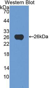 CD71 / Transferrin Receptor Antibody - Western Blot; Sample: Recombinant protein.