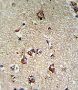 CD71 / Transferrin Receptor Antibody - Formalin-fixed and paraffin-embedded human brain tissue reacted with CD71 Antibody , which was peroxidase-conjugated to the secondary antibody, followed by DAB staining. This data demonstrates the use of this antibody for immunohistochemistry; clinical relevance has not been evaluated.