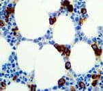 CD71 / Transferrin Receptor Antibody - IHC of CD71 on FFPE Bone Marrow tissue.