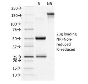 CD71 / Transferrin Receptor Antibody - SDS-PAGE Analysis of Purified, BSA-Free CD71 Antibody (clone TFRC/1396). Confirmation of Integrity and Purity of the Antibody.