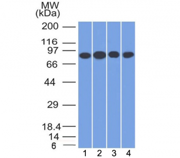 CD71 / Transferrin Receptor Antibody - Western blot testing of human 1) Jurkat, 2) HeLa, 3) MCF7 and K562 cell lysate with CD71 antibody (clone TFRC/1817). Predicted molecular weight: 85-95 kDa.