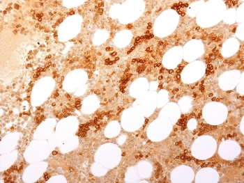 CD71 / Transferrin Receptor Antibody - IHC testing of FFPE human bone marrow with Transferrin Receptor / CD71 antibody (clone TFRC/1817). Required HIER: boil tissue sections in 10mM Tris with 1mM EDTA, pH 9, for 10-20 min followed by cooling at RT for 20 min.