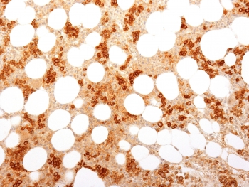 CD71 / Transferrin Receptor Antibody - IHC testing of FFPE human bone marrow with CD71 / Transferrin Receptor antibody (clone TFRC/1818). Required HIER: boil tissue sections in 10mM Tris with 1mM EDTA, pH 9, for 10-20 min followed by cooling at RT for 20 min.