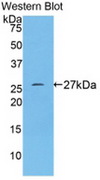 CD71 / Transferrin Receptor Antibody - Western Blot; Sample: Recombinant TFR, Human.