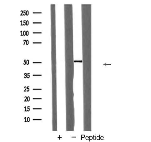 CD71 / Transferrin Receptor Antibody - Western blot analysis of CD71/TfR expression in 293 cells extract