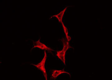 CD71 / Transferrin Receptor Antibody - Staining 293 cells by IF/ICC. The samples were fixed with PFA and permeabilized in 0.1% Triton X-100, then blocked in 10% serum for 45 min at 25°C. The primary antibody was diluted at 1:200 and incubated with the sample for 1 hour at 37°C. An Alexa Fluor 594 conjugated goat anti-rabbit IgG (H+L) Ab, diluted at 1/600, was used as the secondary antibody.