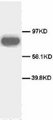 CD71 / Transferrin Receptor Antibody -  This image was taken for the unconjugated form of this product. Other forms have not been tested.