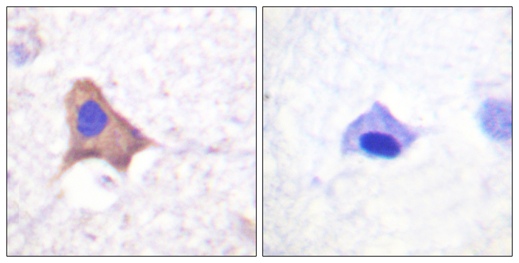 CD71 / Transferrin Receptor Antibody - Immunohistochemistry analysis of paraffin-embedded human brain, using CD71/TfR (Phospho-Ser24) Antibody. The picture on the right is blocked with the phospho peptide.