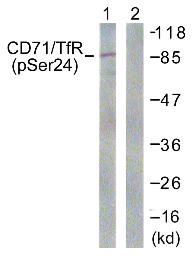 CD71 / Transferrin Receptor Antibody - Western blot analysis of lysates from 293 cells treated with PMA 125ng/ml 30' , using CD71/TfR (Phospho-Ser24) Antibody. The lane on the right is blocked with the phospho peptide.