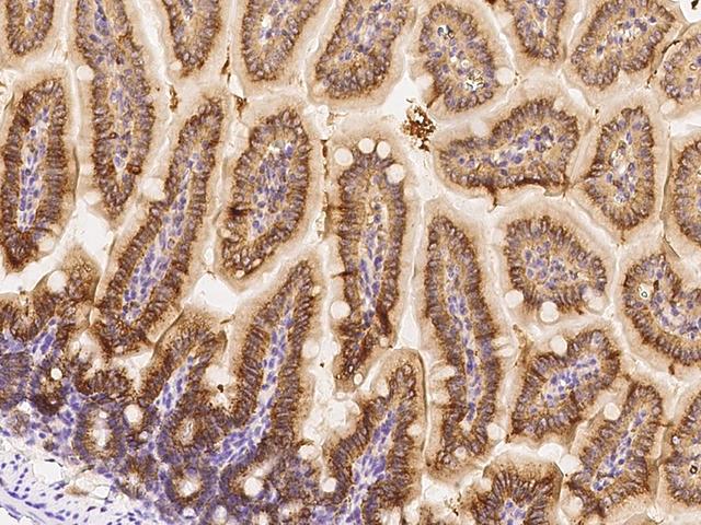 CD71 / Transferrin Receptor Antibody - Immunochemical staining of mouse TFRC in mouse small intestine with rabbit polyclonal antibody at 1:1000 dilution, formalin-fixed paraffin embedded sections.