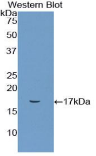 CD72 Antibody - Western blot of recombinant CD72.  This image was taken for the unconjugated form of this product. Other forms have not been tested.