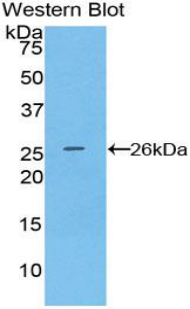 CD72 Antibody - Western blot of recombinant CD72.  This image was taken for the unconjugated form of this product. Other forms have not been tested.