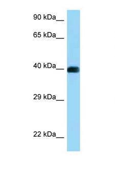 CD72 Antibody - CD72 antibody Western blot of Jurkat Cell lysate. Antibody concentration 1 ug/ml.  This image was taken for the unconjugated form of this product. Other forms have not been tested.