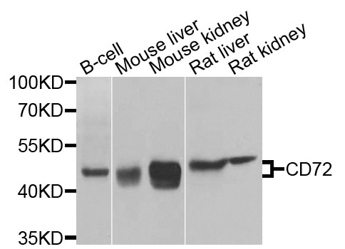 CD72 Antibody - Western blot analysis of extracts of various cells.