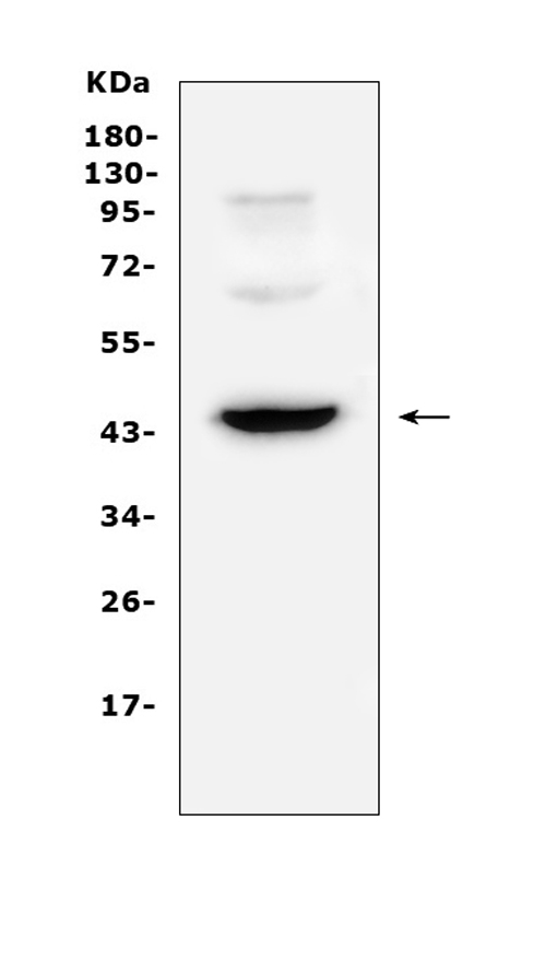 CD72 Antibody - Western blot analysis of CD72 using anti-CD72 antibody. Electrophoresis was performed on a 5-20% SDS-PAGE gel at 70V (Stacking gel) / 90V (Resolving gel) for 2-3 hours. The sample well of each lane was loaded with 50ug of sample under reducing conditions. Lane 1: human A375 whole cell lysate. After Electrophoresis, proteins were transferred to a Nitrocellulose membrane at 150mA for 50-90 minutes. Blocked the membrane with 5% Non-fat Milk/ TBS for 1.5 hour at RT. The membrane was incubated with rabbit anti-CD72 antigen affinity purified polyclonal antibody at 0.5 µg/mL overnight at 4°C, then washed with TBS-0.1% Tween 3 times with 5 minutes each and probed with a goat anti-rabbit IgG-HRP secondary antibody at a dilution of 1:10000 for 1.5 hour at RT. The signal is developed using an Enhanced Chemiluminescent detection (ECL) kit with Tanon 5200 system. A specific band was detected for CD72 at approximately 45KD. The expected band size for CD72 is at 40KD.