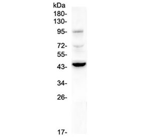 CD72 Antibody - Western blot testing of human A375 cell lysate with CD72 antibody at 0.5ug/ml. Expected molecular weight: 39-45 kDa (monomer), ~86 kDa (dimer).