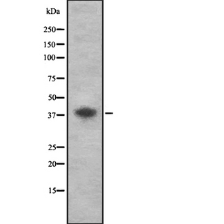 CD72 Antibody - Western blot analysis of CD72 using A549 whole lysates.